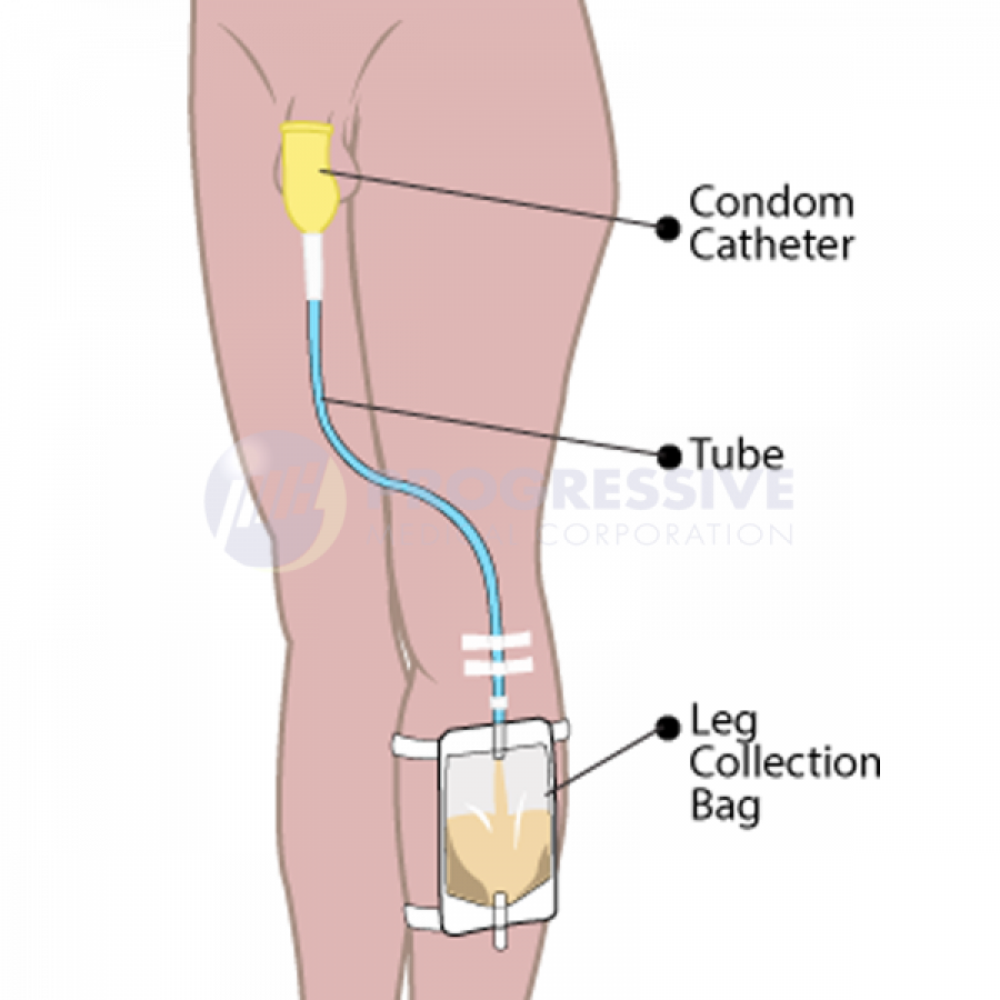 Unimex Male External Condom Catheter2-600x600-900x900
